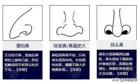 陰溝鼻|【陰溝鼻】陰溝鼻面相解析：窺探性格與運勢